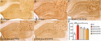 Evaluation of Phytosomal Curcumin as an Anti-inflammatory Agent for Chronic Glial Activation in the GFAP-IL6 Mouse Model